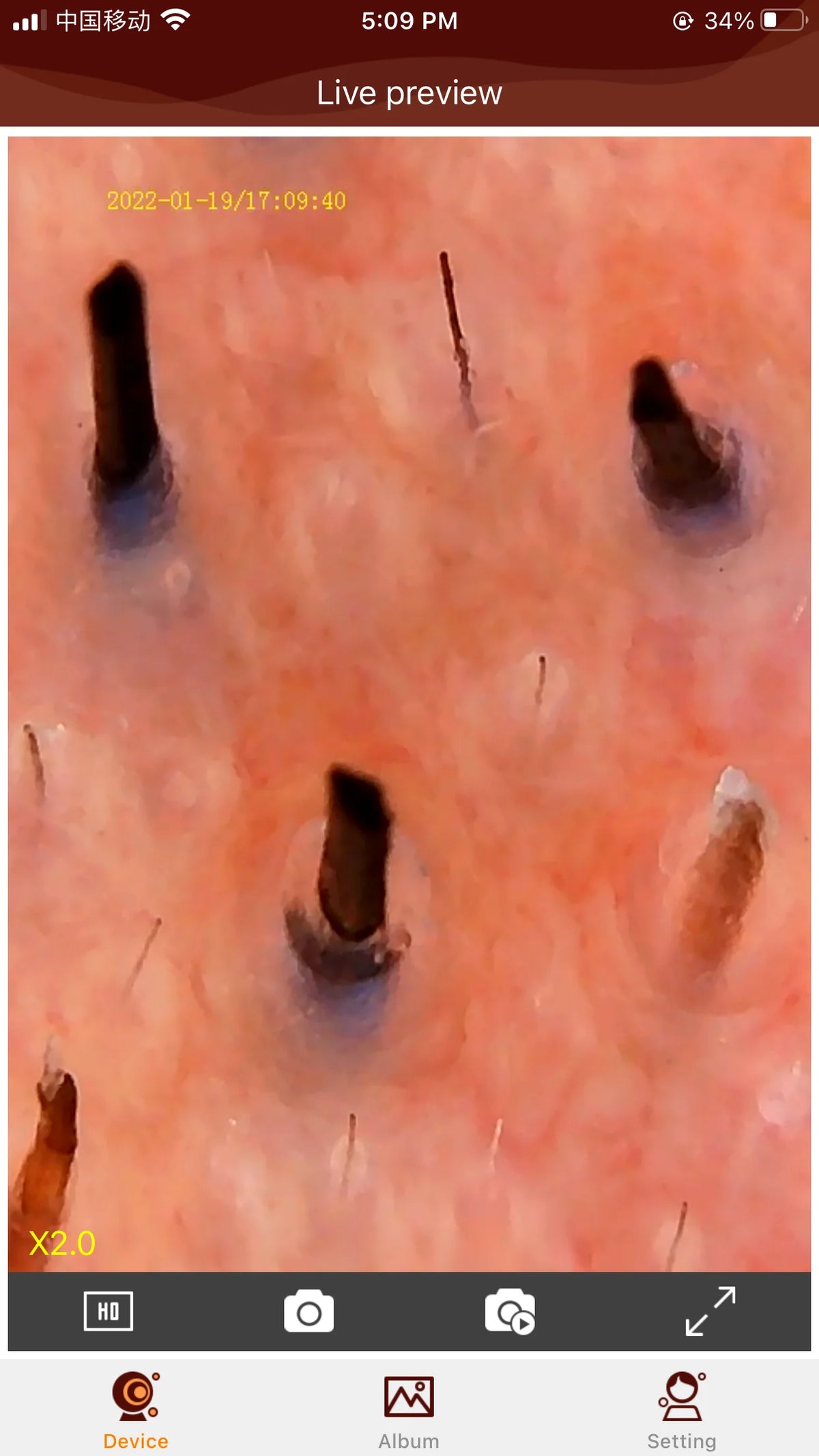 Dermoscopio