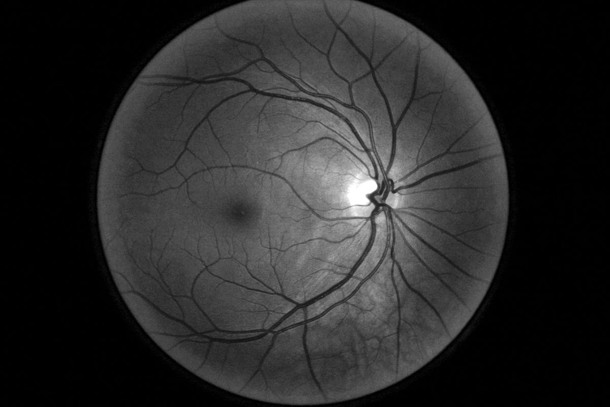 Scanner de retina