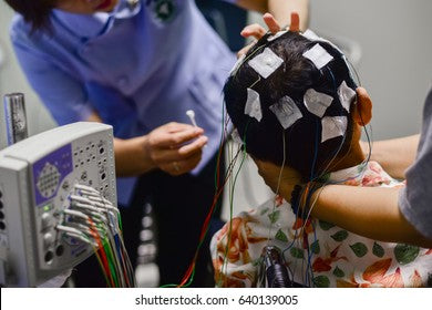 Electroencefalógrafo (EEG)