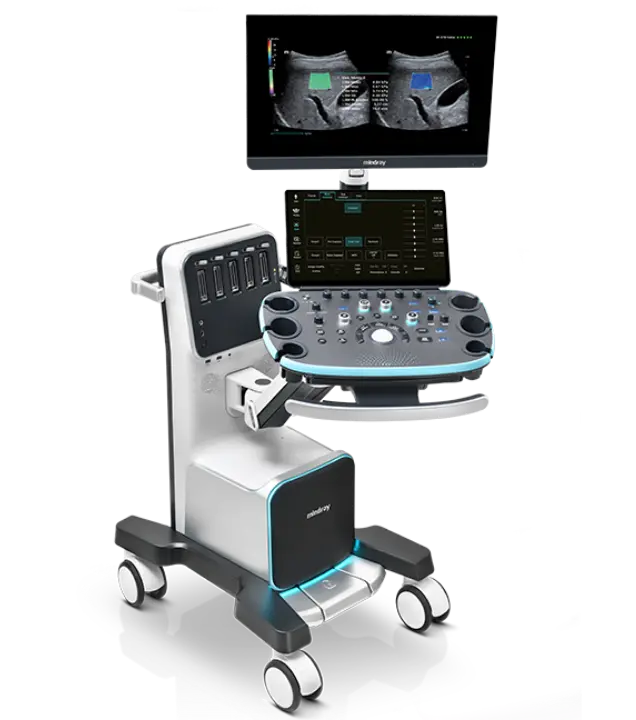 Equipo de ecocardiografía