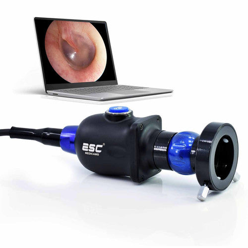 Endoscopio rígido
